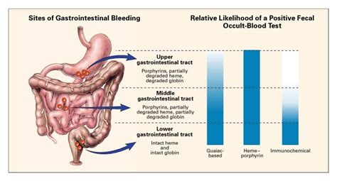 Occult blood in bowel movement icd 10